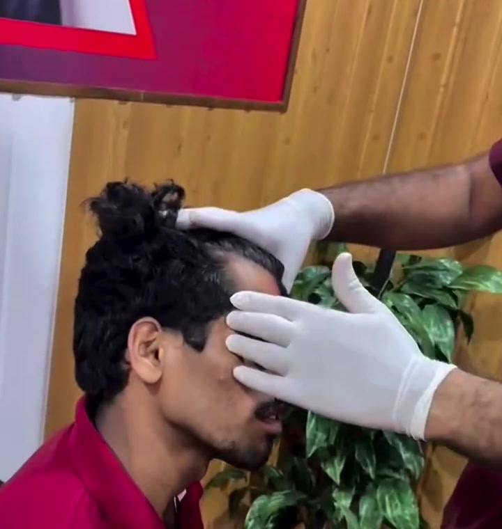 A scalp examination