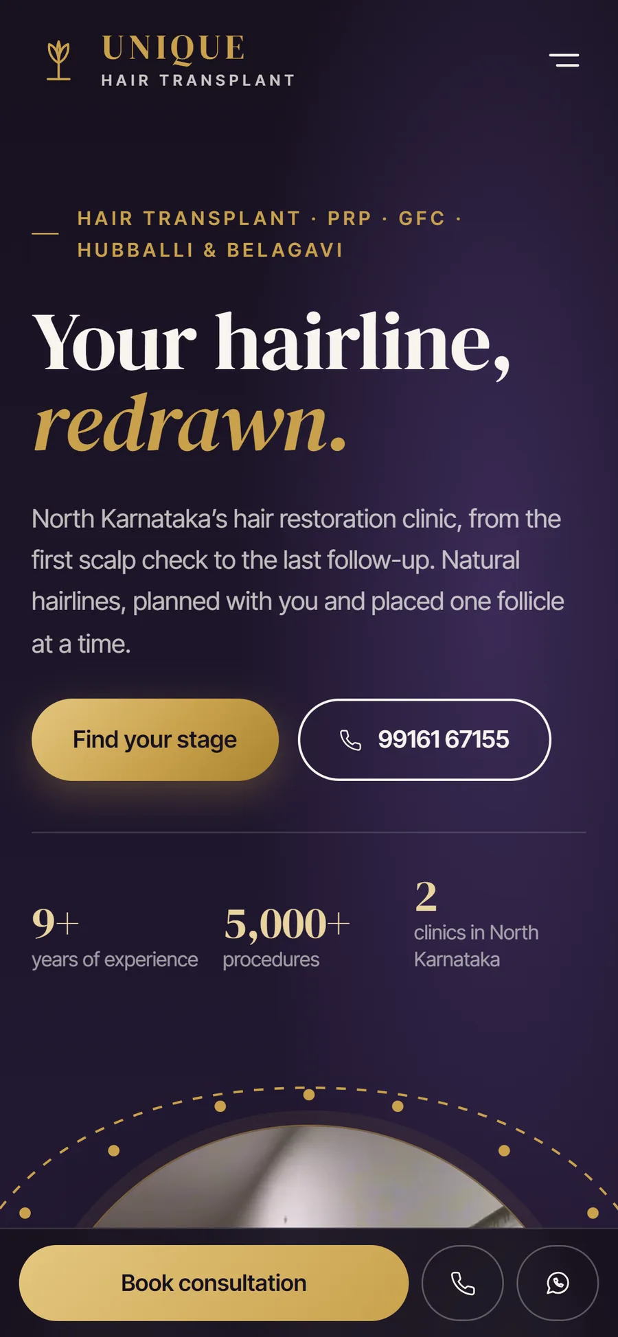 Unique Hair Transplant website on mobile